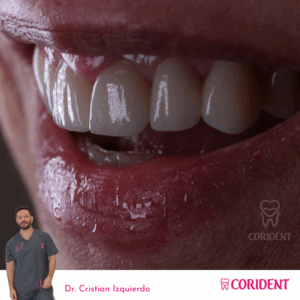 maria del mar sonrisa