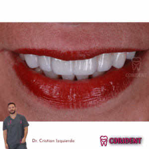 marisol cano sonrisa