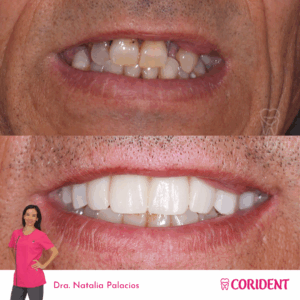 miguel angle sanchez